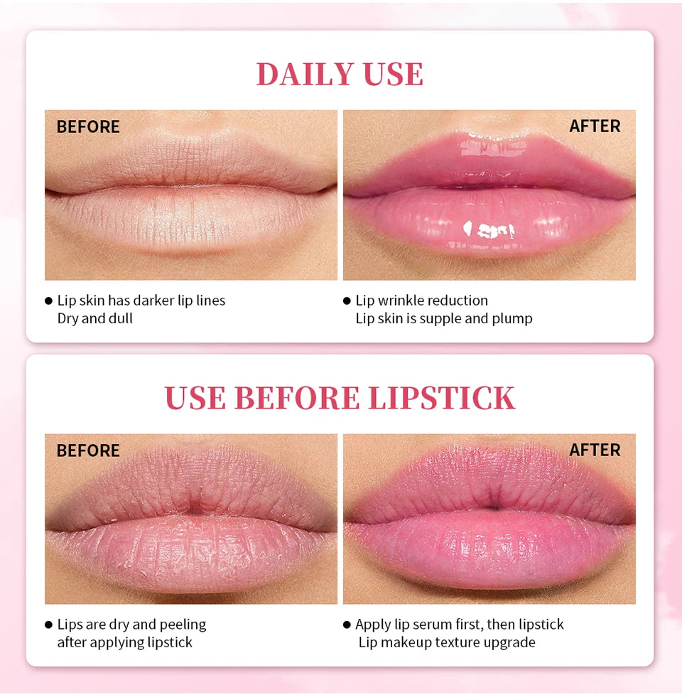 Natural Pink Serum Lips Pink Fresh Remove Dark Lips Gel Lightening Essence Cream Balm Repair Fine Line Brighten Lip Exfoliator